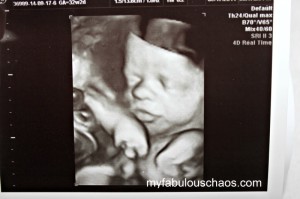 Baby Ultrasound!!